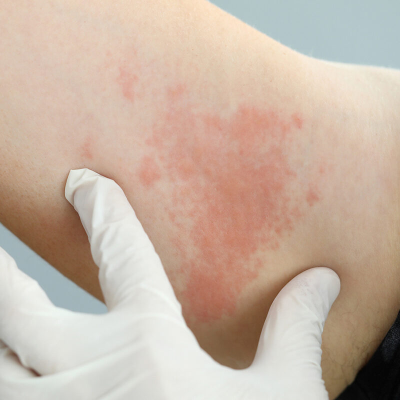 private consultant dermatologist and dermatological surgeon including mohs surgery