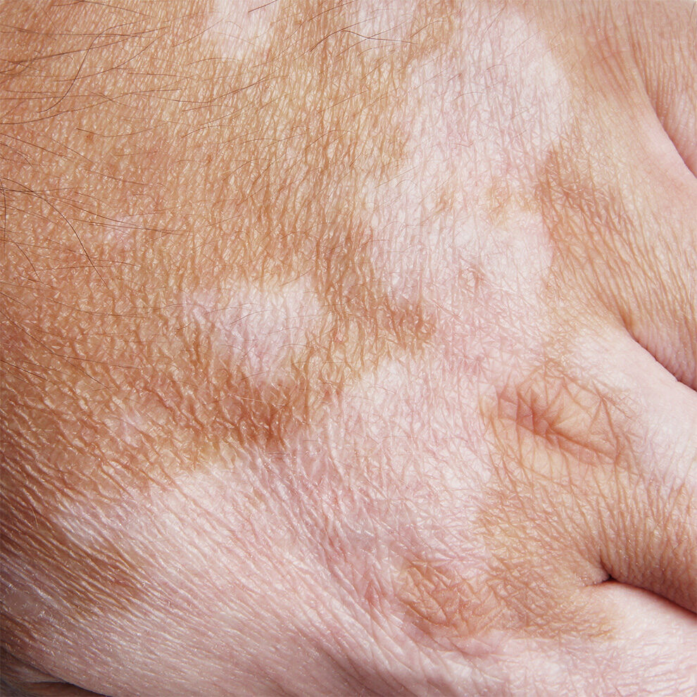 Dr Faisal Ali Dermatology clinic